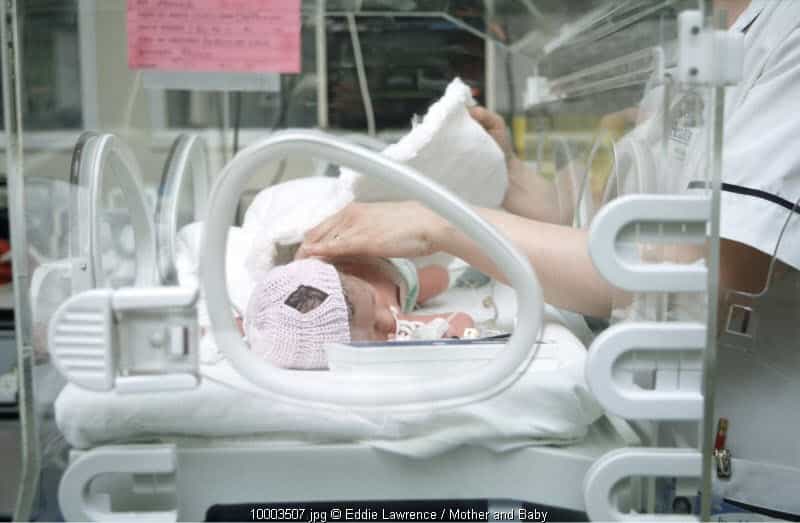 Lahir Prematur karena Plasenta Abrupta