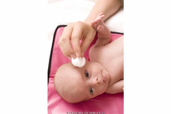 Kenali Penyebab Mata Merah Si Kecil (1)