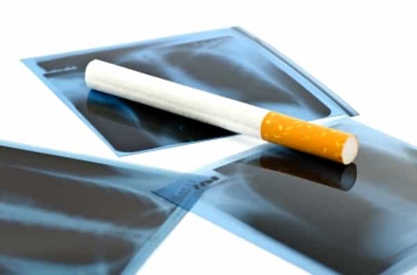 Asap Rokok, Penyebab Utama Gangguan Pernapasan (4)