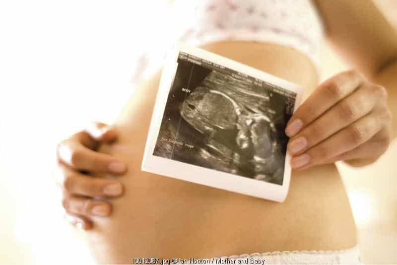 Kegemukan saat Hamil Pengaruhi IQ Anak?