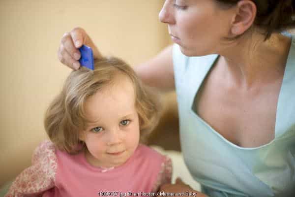Kerontokan Rambut pada Anak Pengidap Kanker