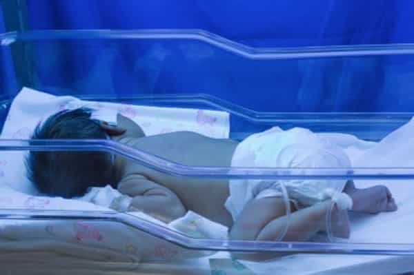 Risiko Kematian Bayi Prematur