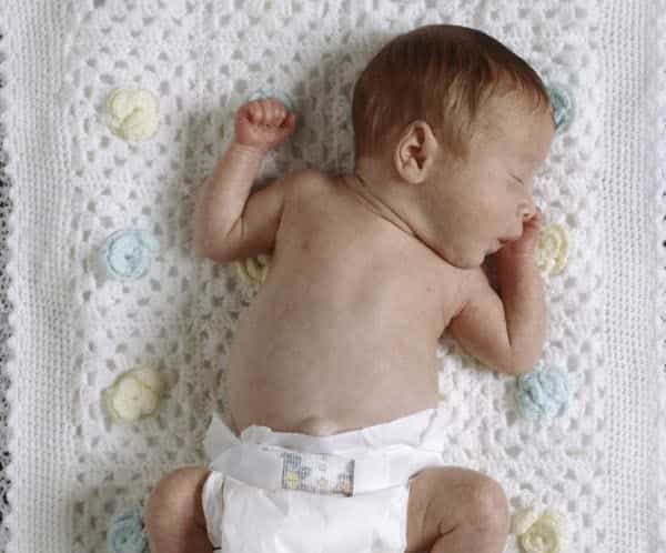 Faktor Penyebab Kelahiran Bayi Prematur