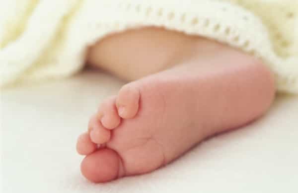 Selulitis pada Bayi