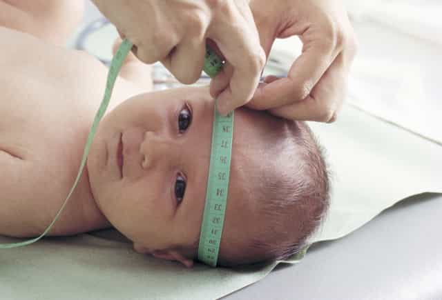 Berat Badan & Lingkar Kepala Tentukan IQ Bayi