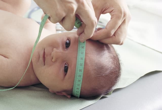 Berat Badan & Lingkar Kepala Tentukan IQ Bayi