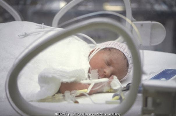 JIka Si Kecil Masuk NICU