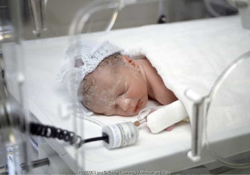 Neonatal Sepsis (2): Gejala dan Faktor Risiko