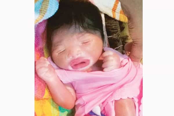 Bayi “Plastik” Lahir di India
