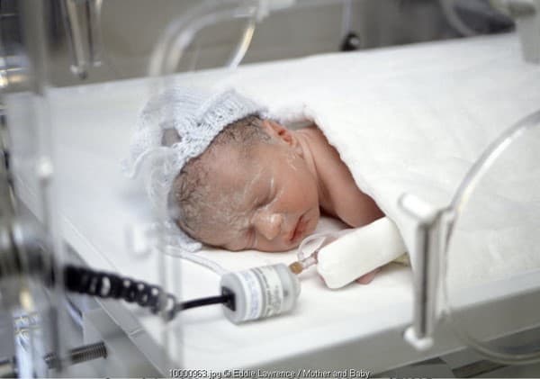 Seluruh Bayi Prematur Berhak Diberikan Perawatan