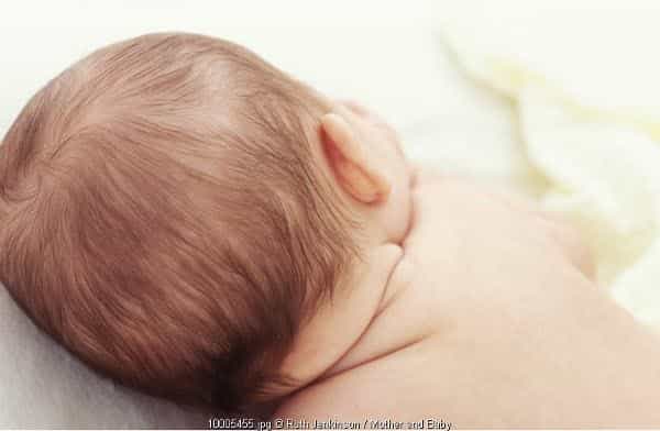 Rambut Bayi Rontok & Botak