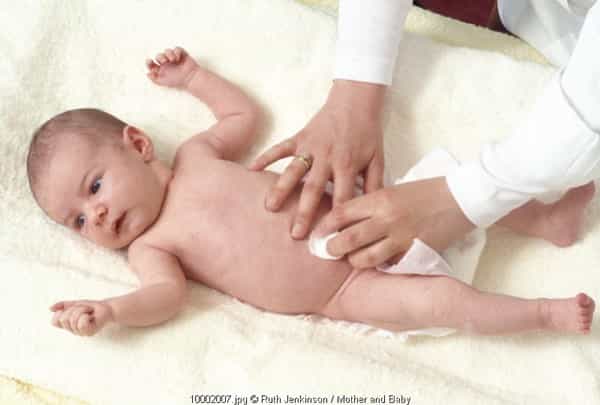 Jenis Hernia Pada Bayi