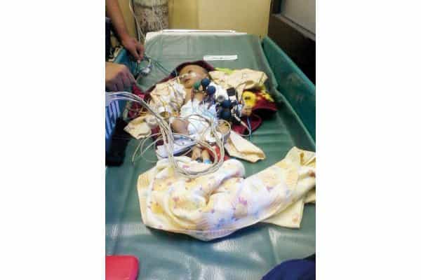 Kisah Faiq (1): Bayi 36 Hari yang Alami Pendarahan Otak