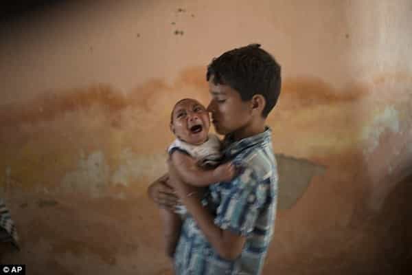 Virus Zika Sebabkan Bayi Lahir Berkepala Kecil