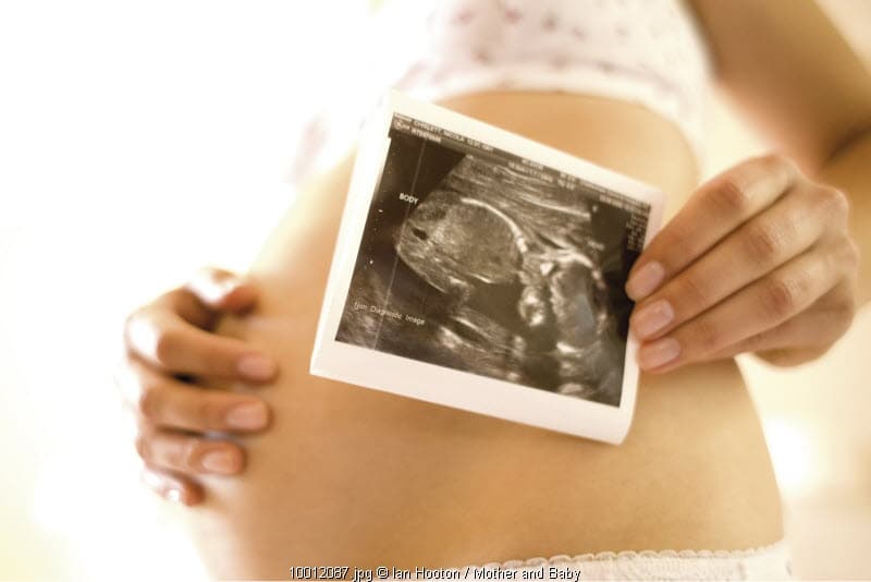 Hamil Bayi Laki-Laki Lebih Rentan Terkena Komplikasi?