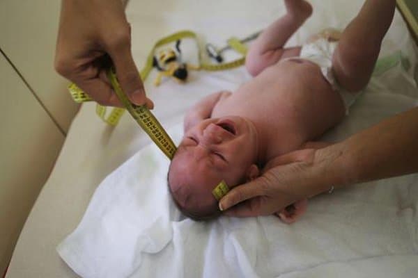 Ditemukan Bayi Zika yang Tuli