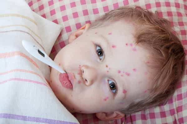 Dampak Alergi Terhadap Tumbuh Kembang Anak