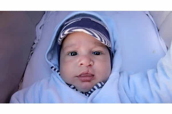 5 Penyebab Bibir Sumbing pada Bayi, Cegah Risikonya!