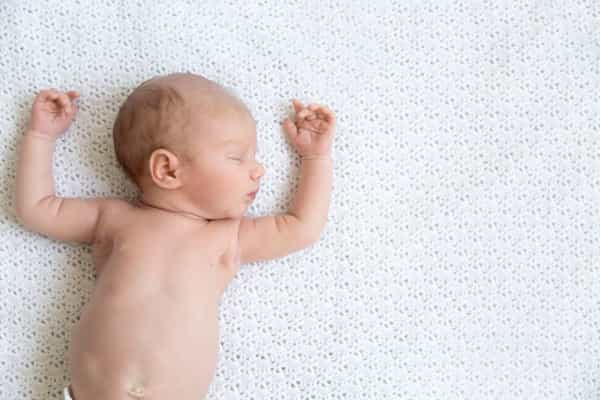 Kulit Bayi Kuning Setelah Dilahirkan, Berbahayakah?
