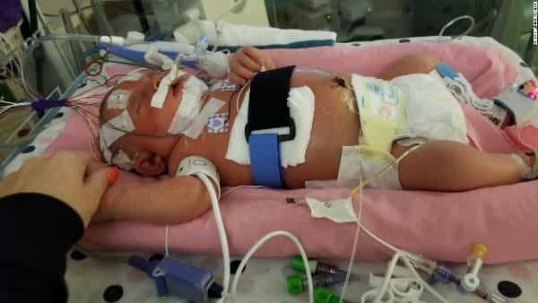 Tragis! Bayi Meninggal karena Dicium Orang Lain