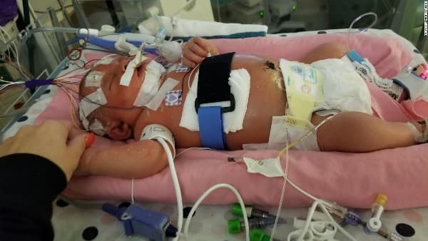 Tragis! Bayi Meninggal karena Dicium Orang Lain