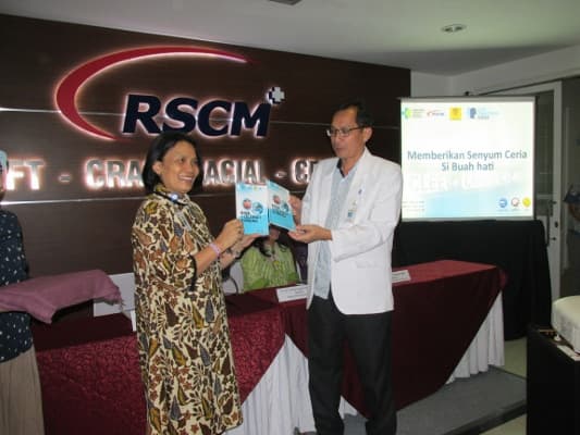 RSCM Hadirkan Fasilitas untuk Tangani Bibir Sumbing