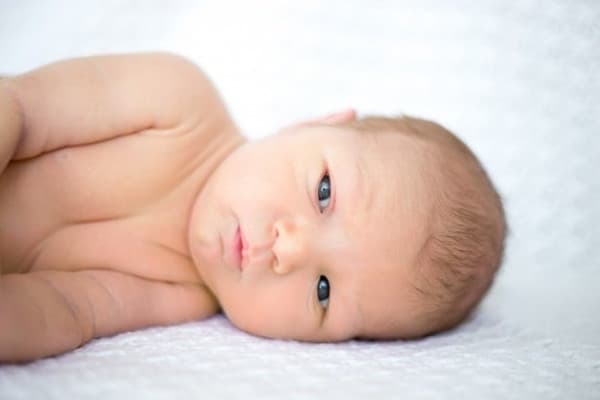 Ini Cara Mengatasi Katarak pada Bayi