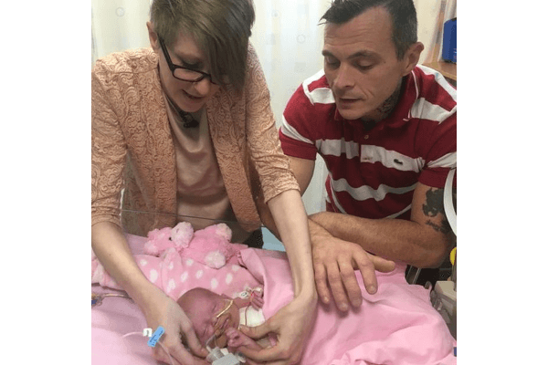 Bayi Lahir dengan Kondisi Jantung Berada di Luar Tubuh