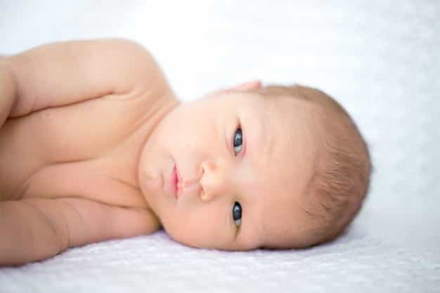 Kenali Intertrigo, Peradangan Kulit Pada Bayi