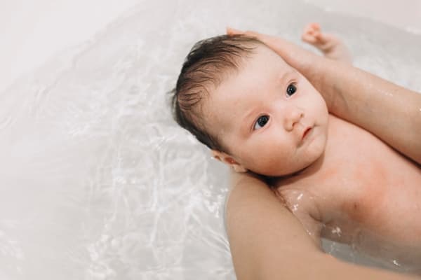 Agar Kulit Bayi Sehat Berseri