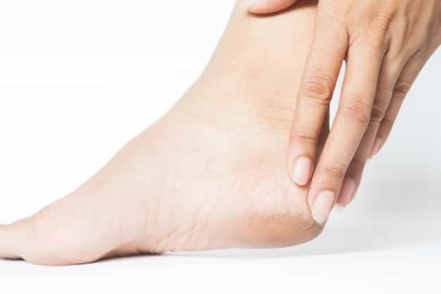 Moms, Ini Cara Mudah Atasi Cracked Heels