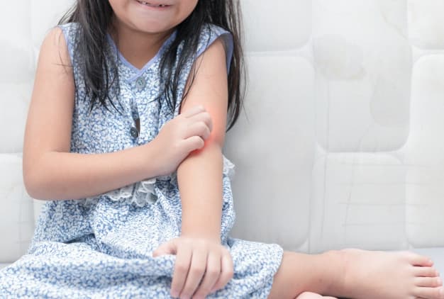 Kenali Cara Pencegahan Alergi pada Anak