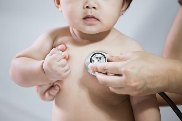 Cara Mengatasi Biang Keringat pada Bayi
