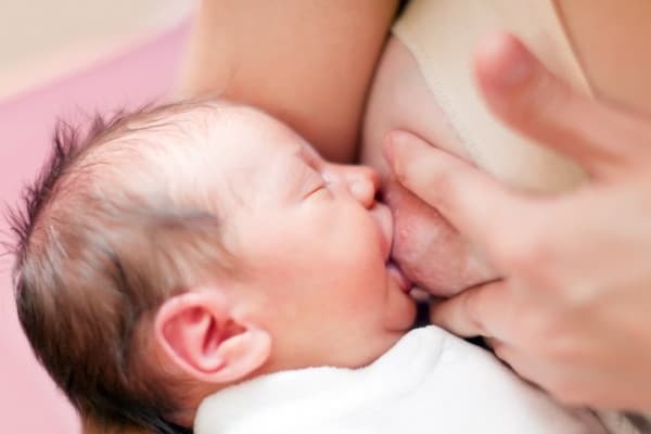 Kenali Milk Blister Saat Menyusui dan Cara Mengatasinya