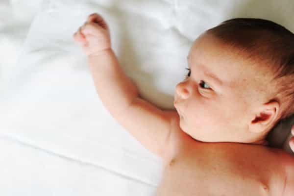 Mengenal dan Mengatasi Penyakit Kuning pada Bayi