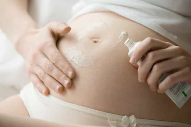 Moms, Ini 5 Tips Mengatasi Stretch Mark saat Hamil