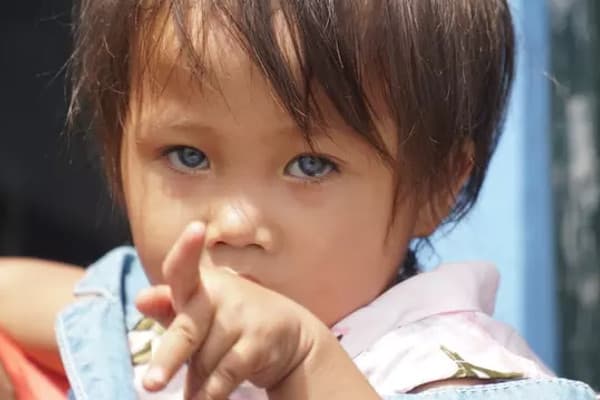 Kisah Unik Balita dengan Warna Bola Mata bisa Berubah