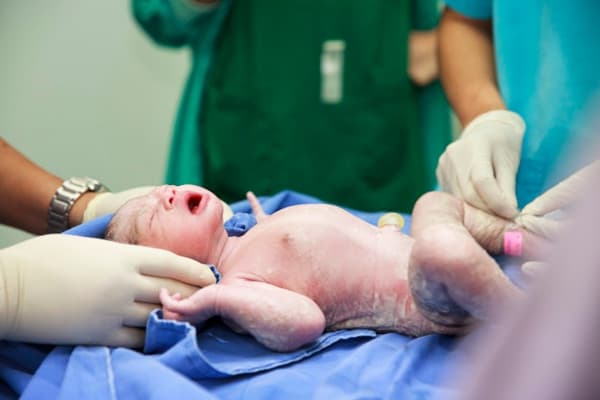 Moms Perlu Tahu, Bayi juga Bisa Terkena Stroke, lho!