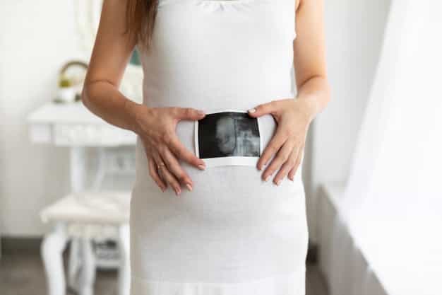 Hindari Hidrosefalus pada Bayi sejak dalam Kandungan