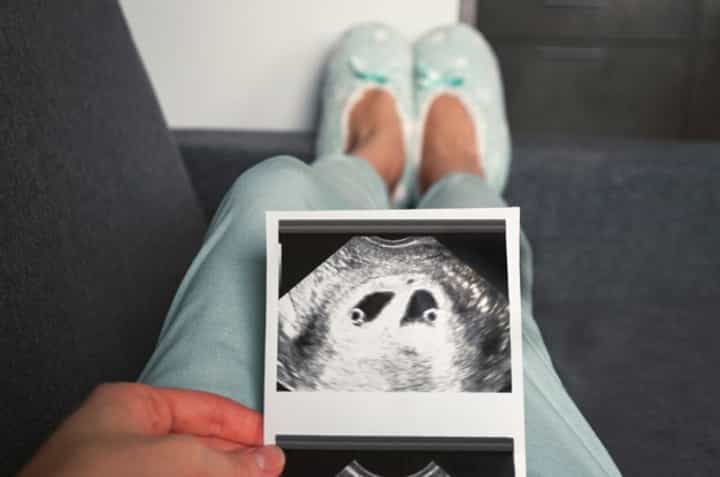 Janin di Dalam Janin? Ketahui Fakta Fetus in Fetu!