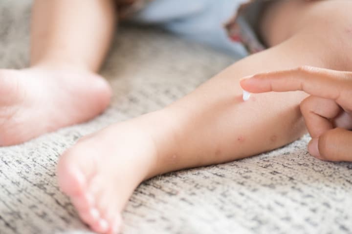 Apakah Losion Anti Nyamuk Aman Diberikan pada Bayi?