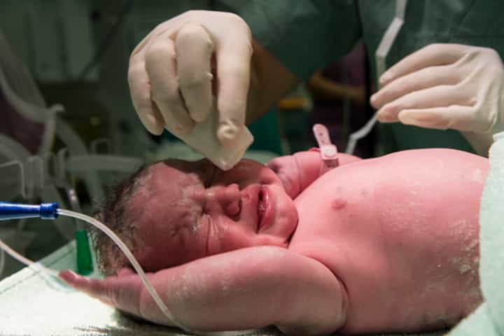 Ini Alasan Bayi Baru Lahir Harus Menangis