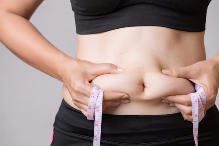 Diastasis Recti, Penyebab Perut tak Kempes Usai Lahiran