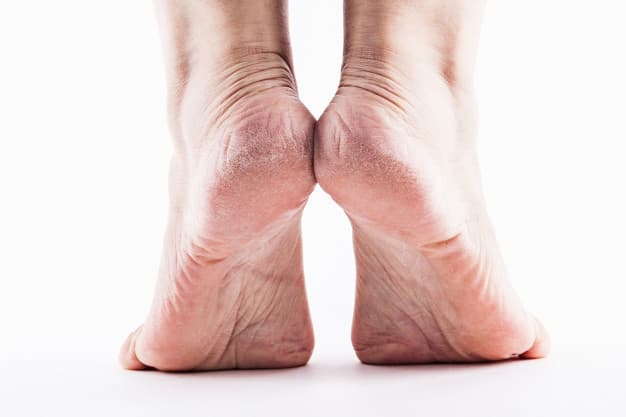 Moms, Ini Cara Tepat Tangani Kulit Kaki Pecah-pecah