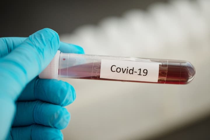 Hal-hal yang Wajib Diketahui tentang Tes COVID-19