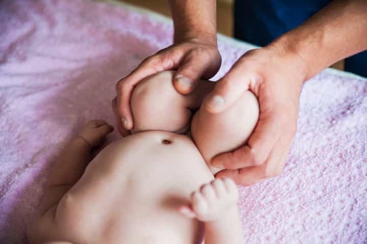 Waspada Hipospadia, Kelainan Kelamin pada Bayi Laki-laki