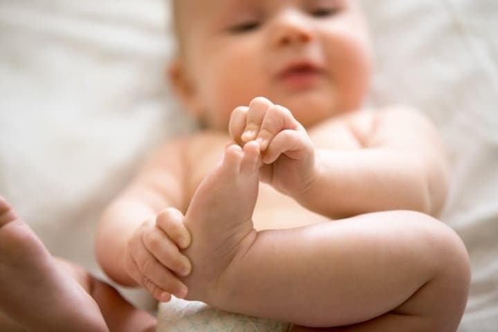 Polidaktili, Kelainan Jari yang Terjadi pada Bayi