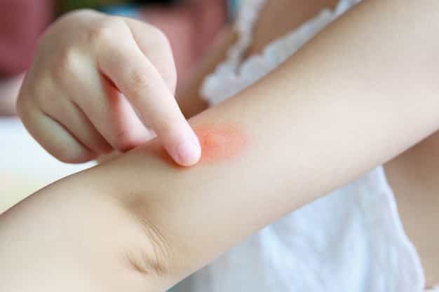 Anak Sering Bentol karena Darah Manis? Ini Penyebab dan Solusinya