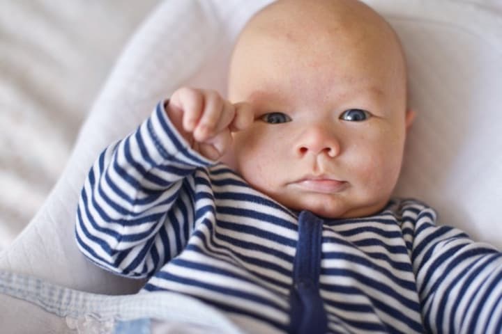 Biang Keringat pada Bayi, Ini Penyebab dan Cara Mengatasinya