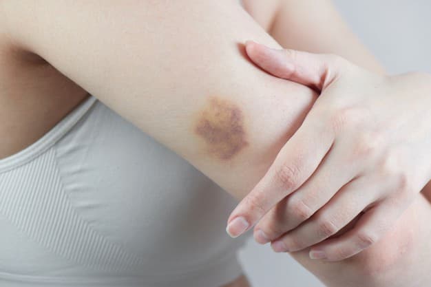 Tubuh Mudah Memar? Kenali 7 Tanda Kekurangan Vitamin K